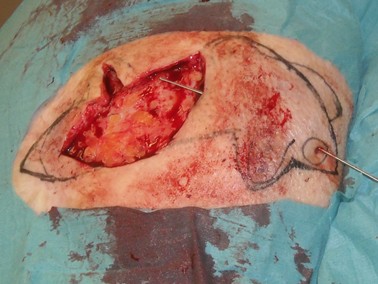 Dubbele katrolhechting