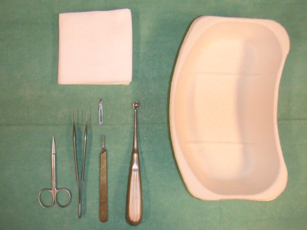 Debridement van ulcera