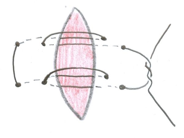 Dubbele katrolhechting (double pulley stitch) Dubbele katrolhechting (double pulley stitch)