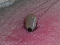 tick bitten into the skin