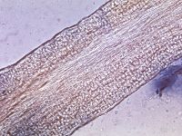 Endothrix groeiwijze schimmel