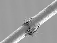 Trichorrhexis nodosa