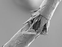 Trichorrhexis nodosa