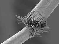 Trichorrhexis nodosa