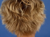 Uncombable hair syndrome