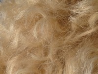 Uncombable hair syndrome