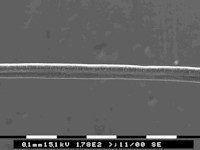 Uncombable hair syndrome