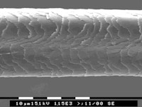 Uncombable hair syndrome