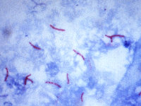 Mycobacterium marinum of balnei
