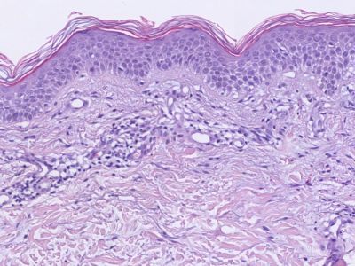 Histologie geneesmiddelreactie