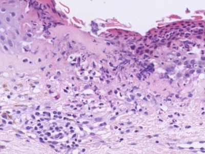 Histologie geneesmiddelreactie