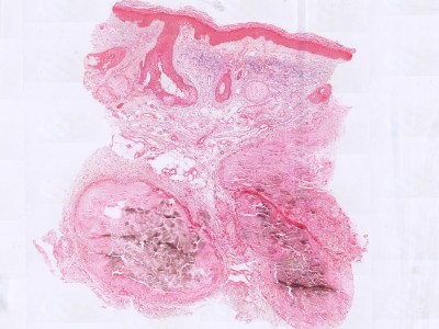 Histologie jicht tophus