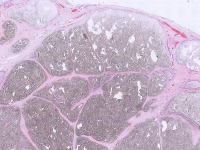 Histologie jicht tophus