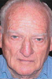 Efudix treatment Efudix