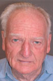 Efudix treatment Efudix